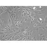 Rat Hepatic Stellate Cells (RHSC)